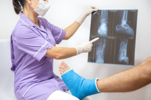 Calcific Tendinitis of Shoulder